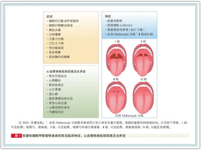 无创呼吸机,高流量呼吸湿化治疗仪,睡眠监测