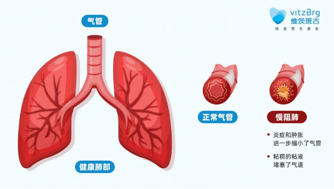 无创呼吸机,高流量呼吸湿化治疗仪,睡眠监测