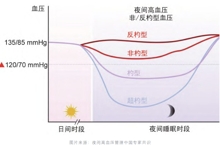 无创呼吸机,高流量呼吸湿化治疗仪,睡眠监测